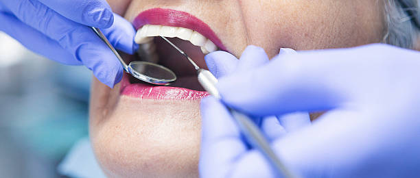 Best Emergency Wisdom Tooth Extraction in Berlin, NJ